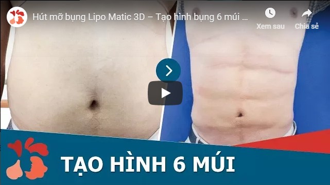 video tạo 6 múi
