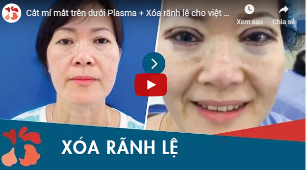 khách hàng xóa rãnh lệ