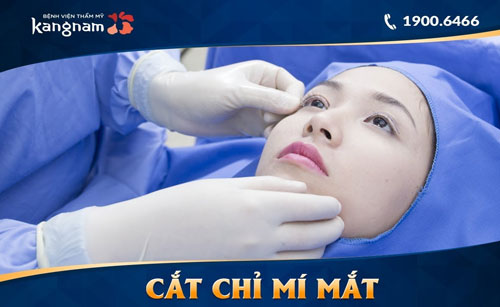 cách chăm sóc mí mắt sau khi cắt chỉ