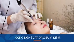 Cấy da siêu vi điểm là gì? Giải đáp mọi thắc mắc về phương pháp làm đẹp da hot nhất hiện nay