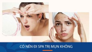 Lấy lại làn da mịn màng, không tì vết với Spa Trị Mụn