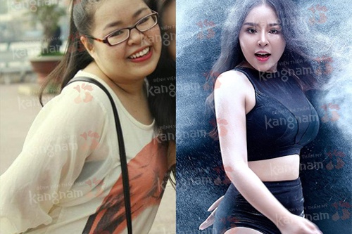hút mỡ bắp tay giá bao nhiêu