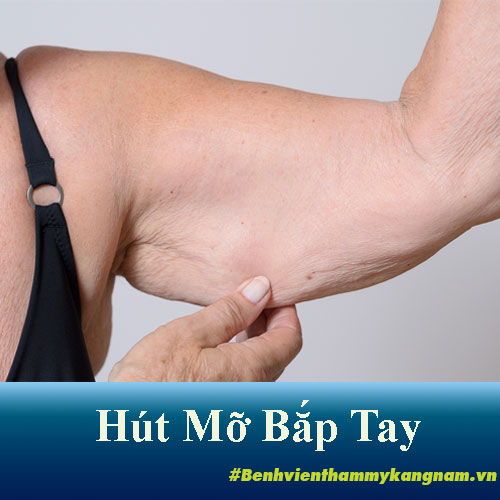 hút mỡ bắp tay