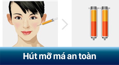 hút mỡ mặt có ảnh hưởng gì không