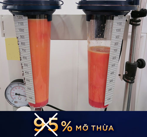 hút mỡ cánh tay có đau không