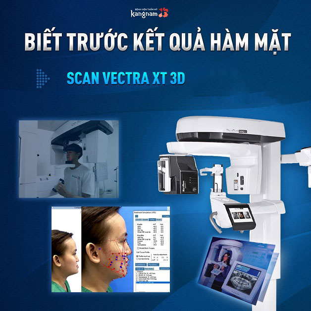 Sử dụng công nghệ Vectra XT 3D để xem trước kết quả khuôn mặt sau phẫu thuật