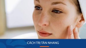 Tàn nhang xuất hiện khi nào? Cách thoát khỏi tàn nhang