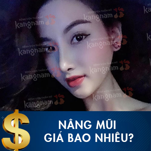 Nâng mũi giá bao nhiêu tiền? Bảng chi phí sửa mũi mới nhất tại Kangnam