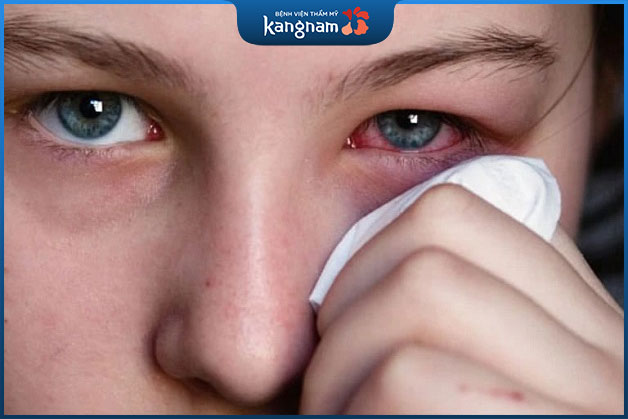 Sử dụng phấn trang điểm mắt kém chất lượng có thể gây kích ứng. 