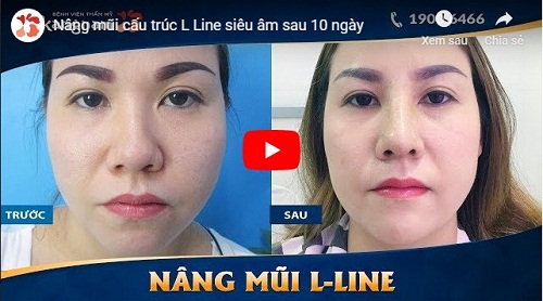 video sau 10 ngày