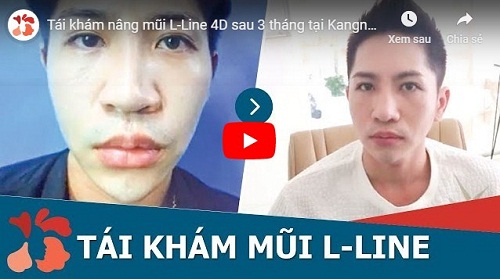 video sau 3 tháng