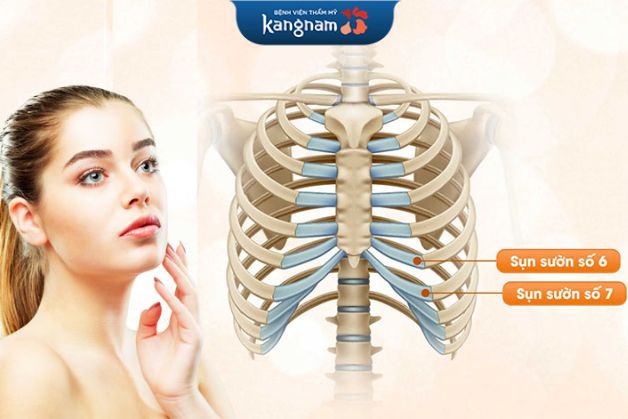 Nâng mũi sụn sườn có độ an toàn cao