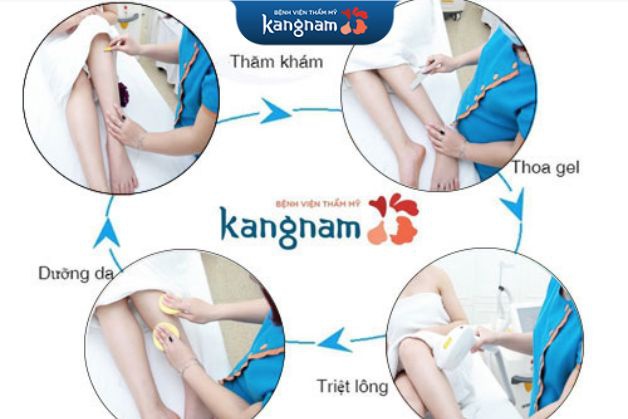 Quy trình triệt lông an toàn tại Kangnam