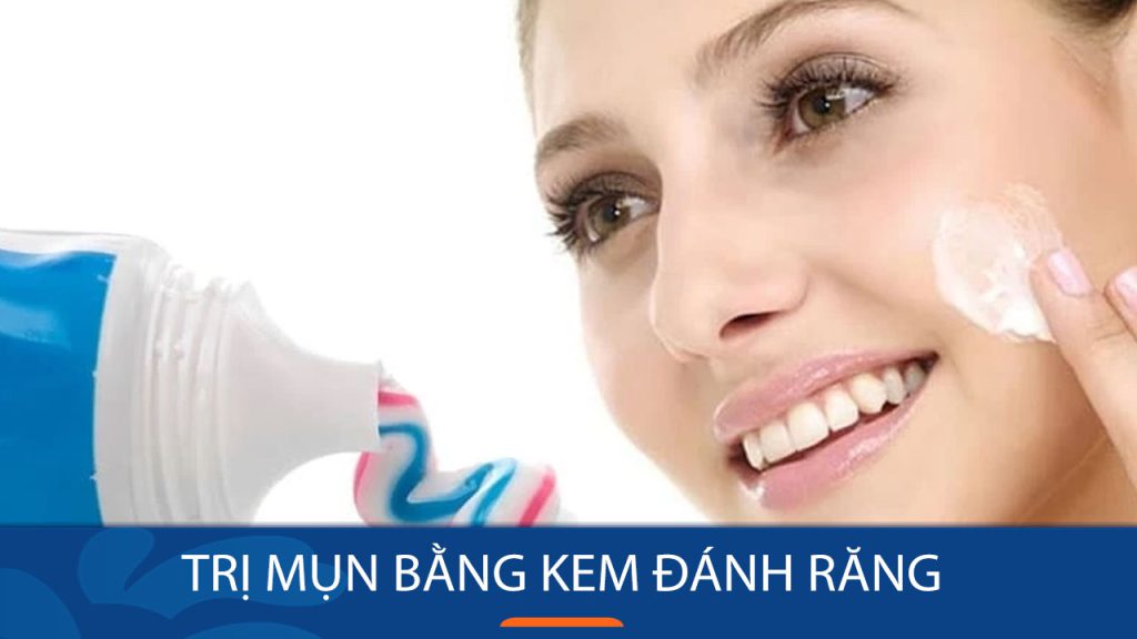 Trị Mụn Nhanh Chóng Bằng Kem Đánh Răng: Bí Quyết Hiệu Quả