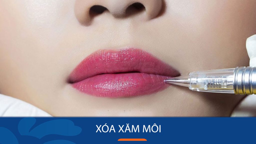 Xóa xăm môi bằng cách nào tốt nhất? Có đau không? Có để lại sẹo không?