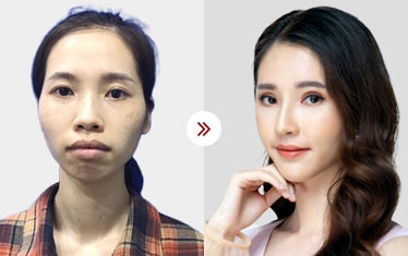 chỉnh sửa hàm