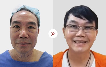 trẻ hóa da