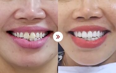 thẩm mỹ nha khoa
