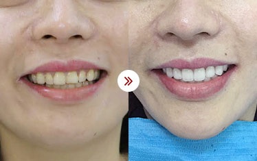 thẩm mỹ nha khoa