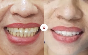hình ảnh thẩm mỹ nha khoa