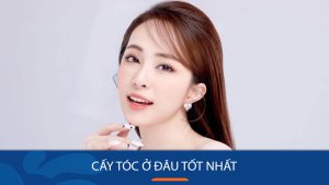 Cấy tóc ở đâu tốt nhất? Review địa chỉ cấy tóc uy tín