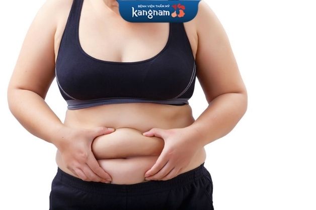 Có nên hút mỡ bụng?