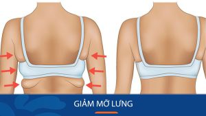 10 cách giảm mỡ lưng, vai Nhanh, Hiệu quả nhất cho Nam, Nữ