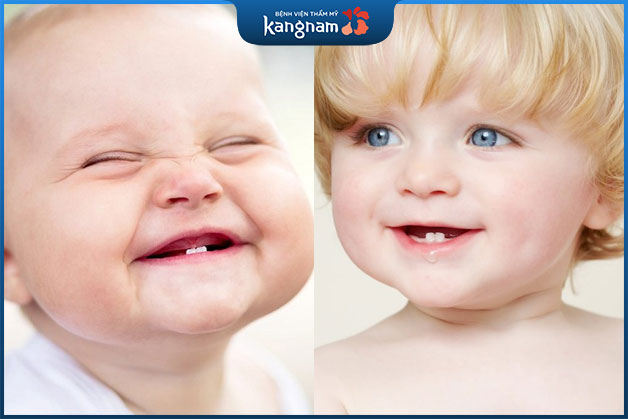Hàm móm có thể di truyền từ bố mẹ sang con cái
