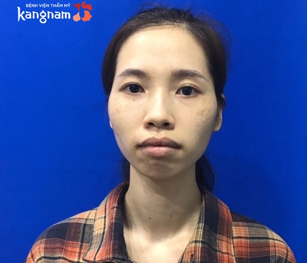 hô hàm