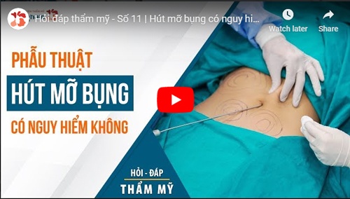 video hút mỡ bụng