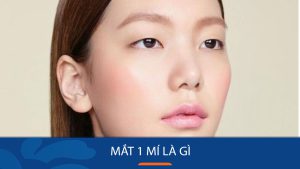 Mắt một mí: Giải mã đặc điểm, nguyên nhân và các loại