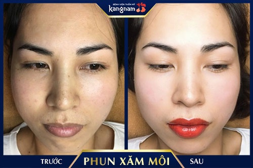 phun môi collagen ở đâu đẹp 