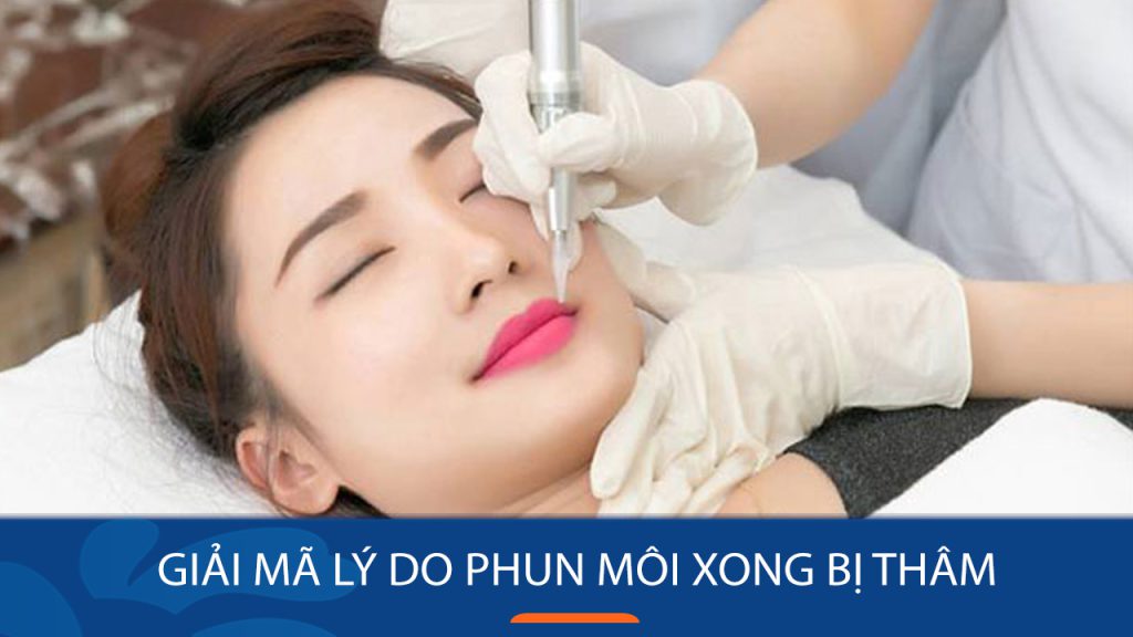 Giải mã lý do phun môi xong bị thâm? Nguyên nhân và cách khắc phục
