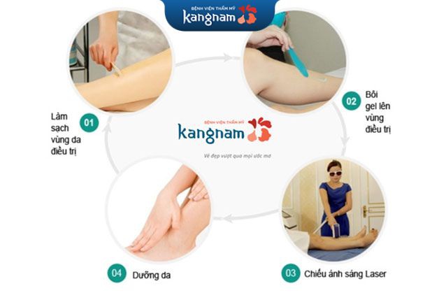 Quy trình triệt lông tại Kangnam đều đã được kiểm chứng an toàn từ Bộ y tế