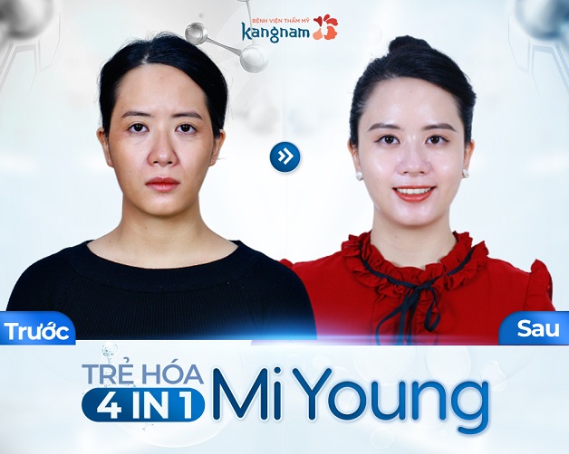 Công nghệ trẻ hóa Mi Young giúp lấy lại làn da đàn hồi
