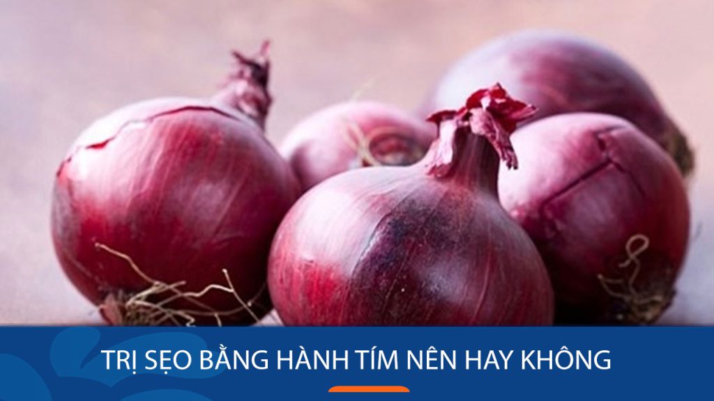 Bí quyết trị sẹo thâm, sẹo lồi hiệu quả bằng hành tím ngay tại nhà