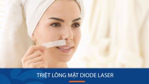 Triệt lông mặt Diode Laser: Bí quyết cho làn da mịn màng, trắng sáng