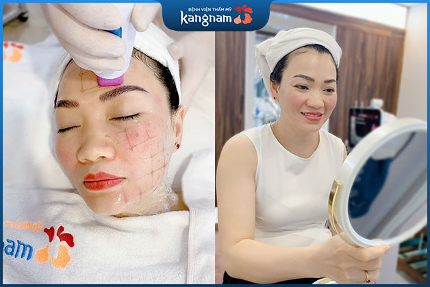 Da căng bóng sáng hồng sau khi trẻ hóa da mặt tại Kangnam