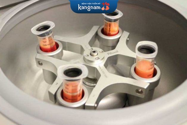 Thiết bị quay ly tâm hiện đại của Kangnam sẽ giúp chiết tách các mô mỡ khỏe nhất trước đi cấy cho khách hàng