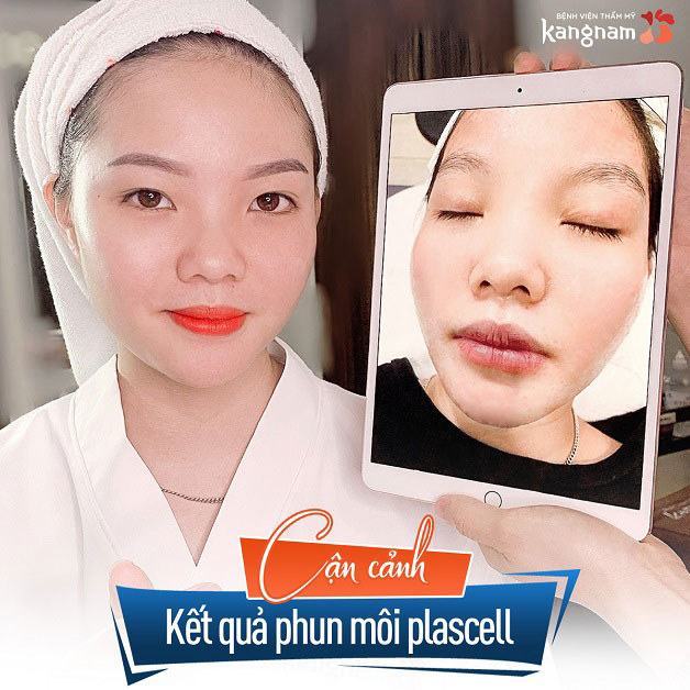 Tạm biệt ngay môi thâm xỉn, tự tin với cánh môi tươi xinh