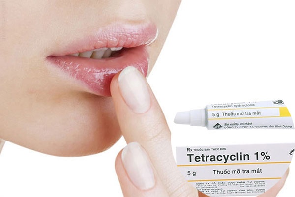 bôi thuốc mỡ tetracyclin sau khi xăm môi