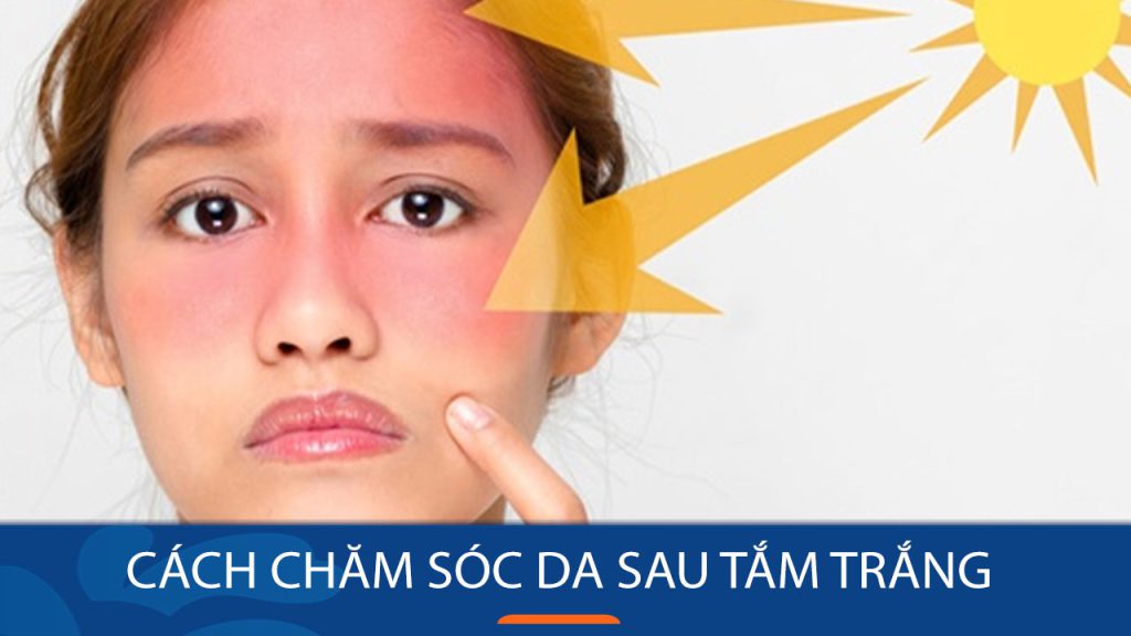 Cách bảo vệ da khỏi tác hại của ánh nắng mặt trời sau khi tắm trắng