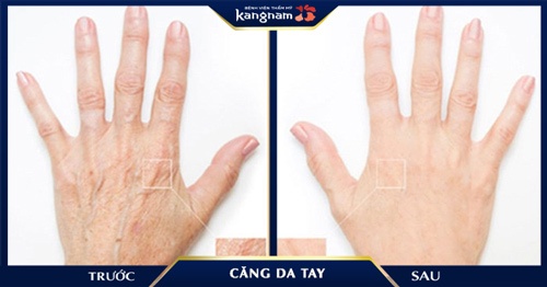 cách làm da tay căng mịn