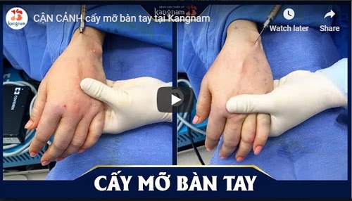 video chữa nhăn da tay