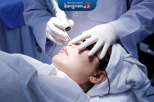 lý do nên tẩy nốt ruồi ở kangnam
