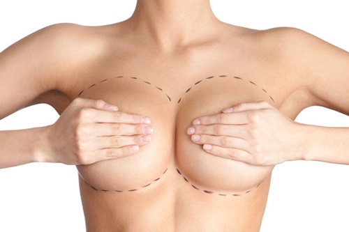 Sau phẫu thuật cần massage để ngực mềm mại tự nhiên hơn 