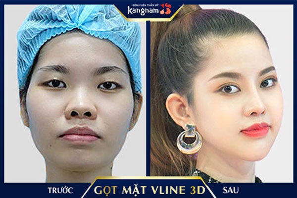 cấu tạo mặt kim cương