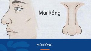 Mũi Rồng là mũi như thế nào? Luận tướng người, đoán vận mệnh