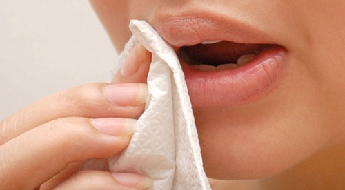 chăm sóc môi sau phun