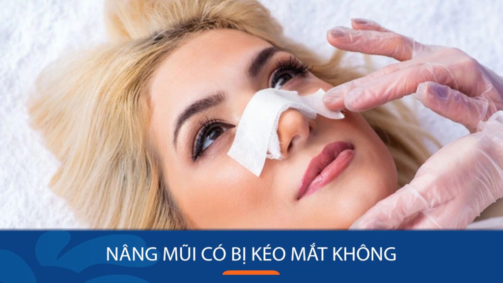 Nâng mũi có bị kéo mắt không? Giải đáp từ chuyên gia thẩm mỹ